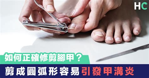 剪腳甲|【生活知識】如何正確修剪腳甲？剪成圓弧形容易引發。